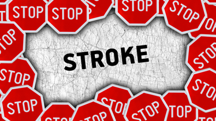 Stroke – Prevention Techniques